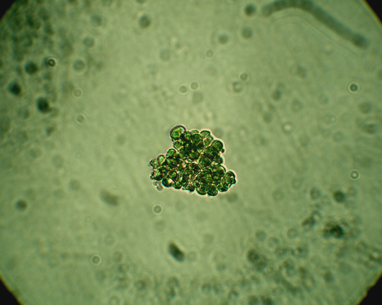 Poltiglia verde: Desmococcus olivaceus